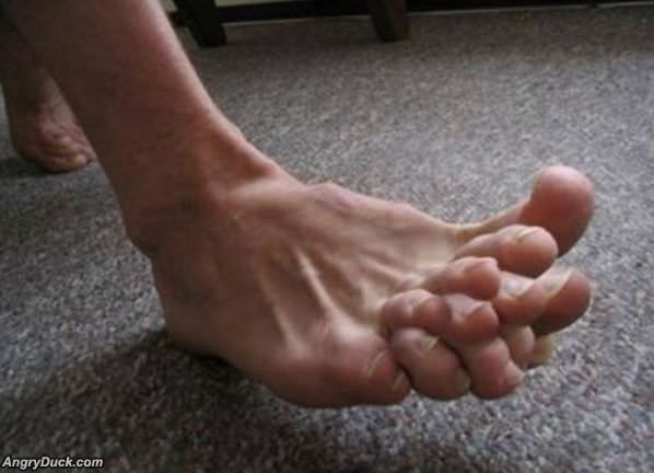 Crazy Toes