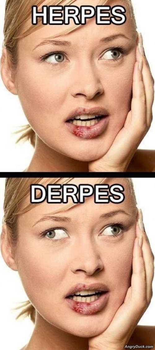 Herpes And Derpes