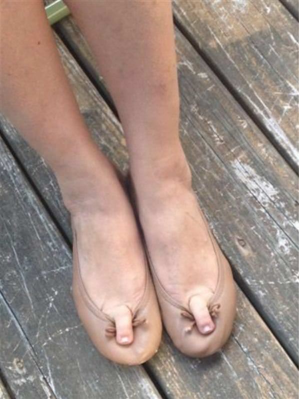 Weird Toes