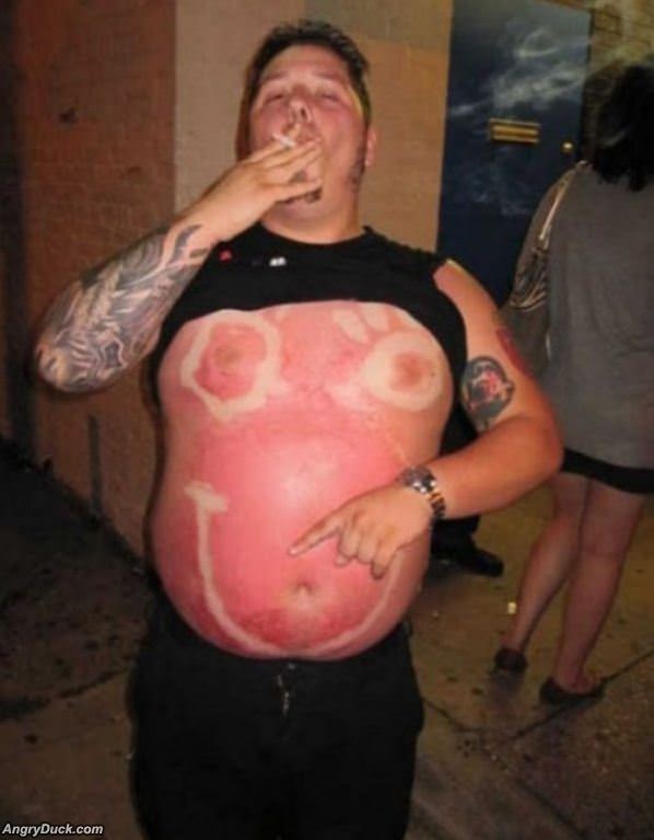 Sunburn Like A Boss