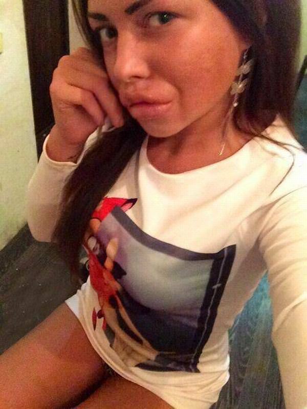 What Did You Do To Your Face