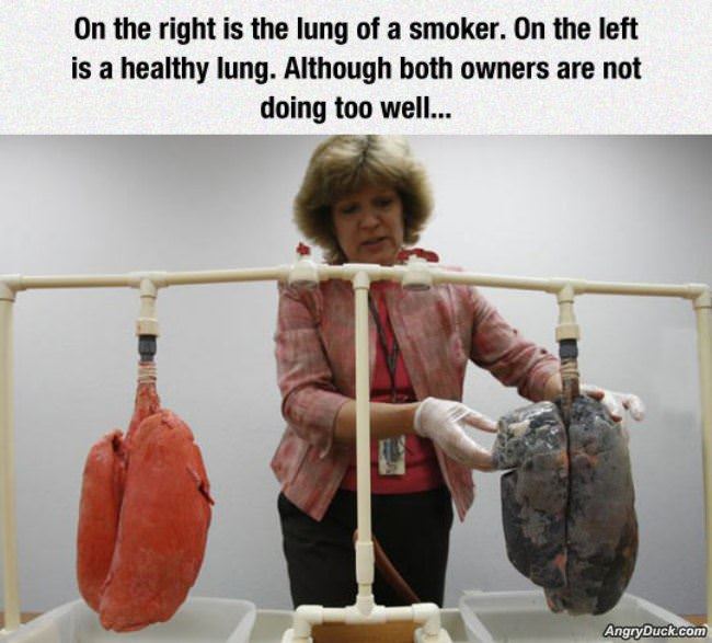 Smokers Lungs
