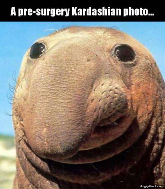 Pre Surgery Kardashian Photo