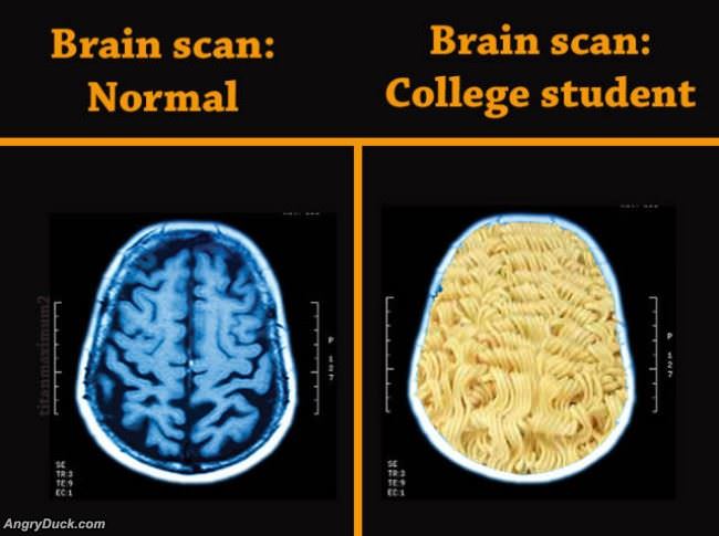 Brain Scans