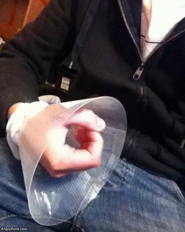 Injured