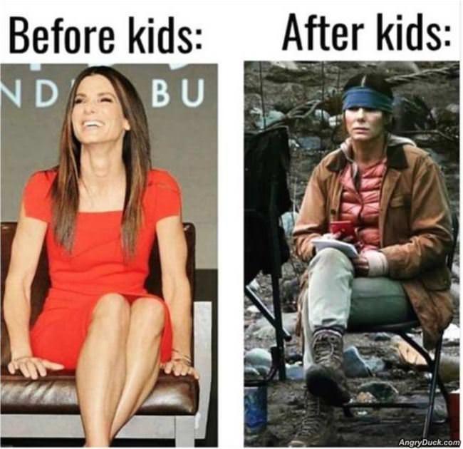 Before And After Kids