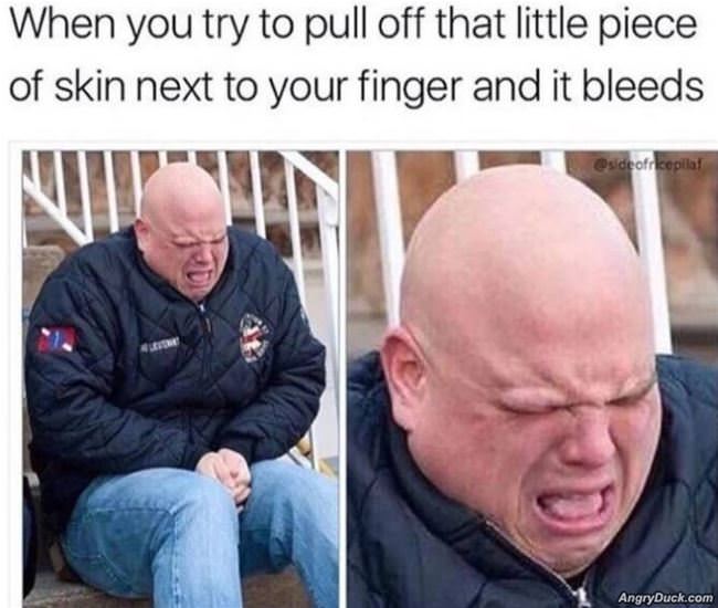 That Piece Of Skin