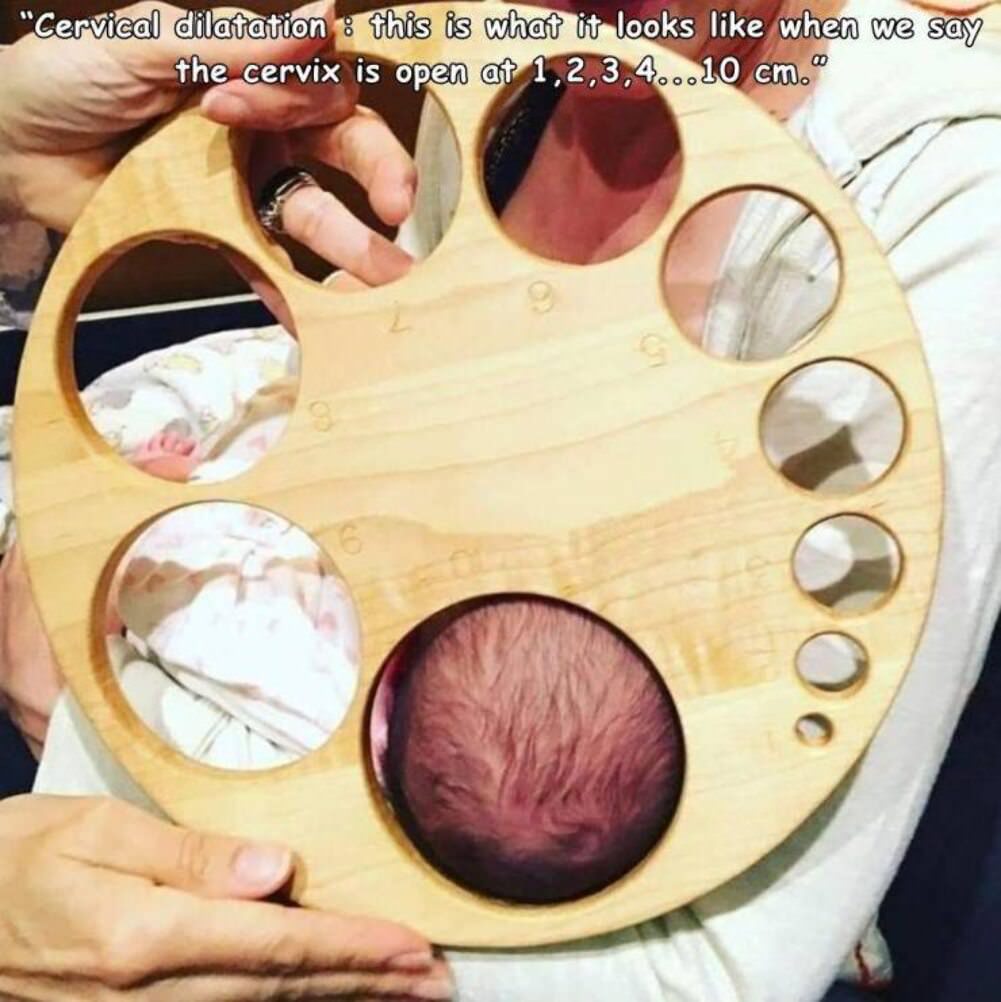 this is what it looks like