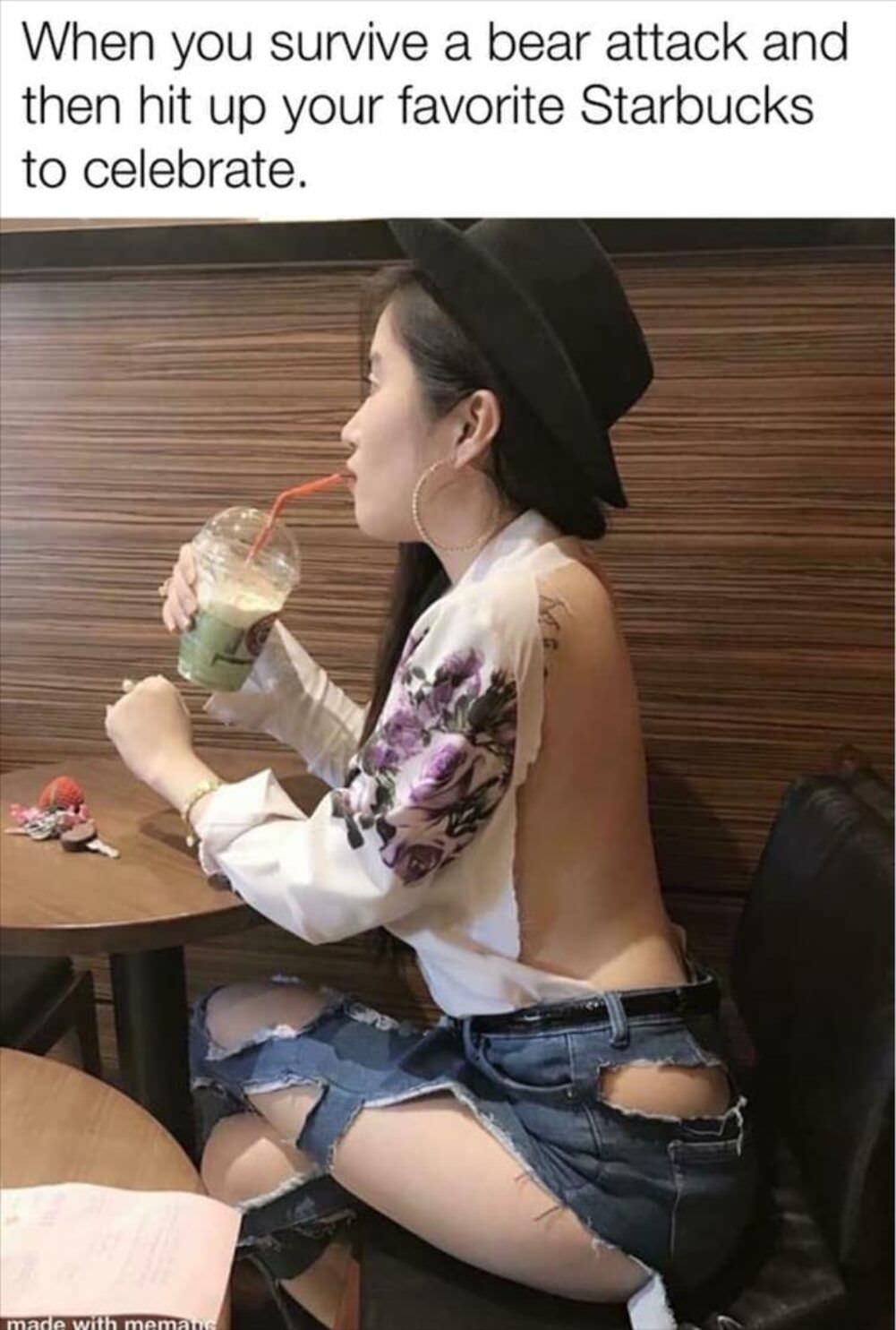 suvived a bear attack