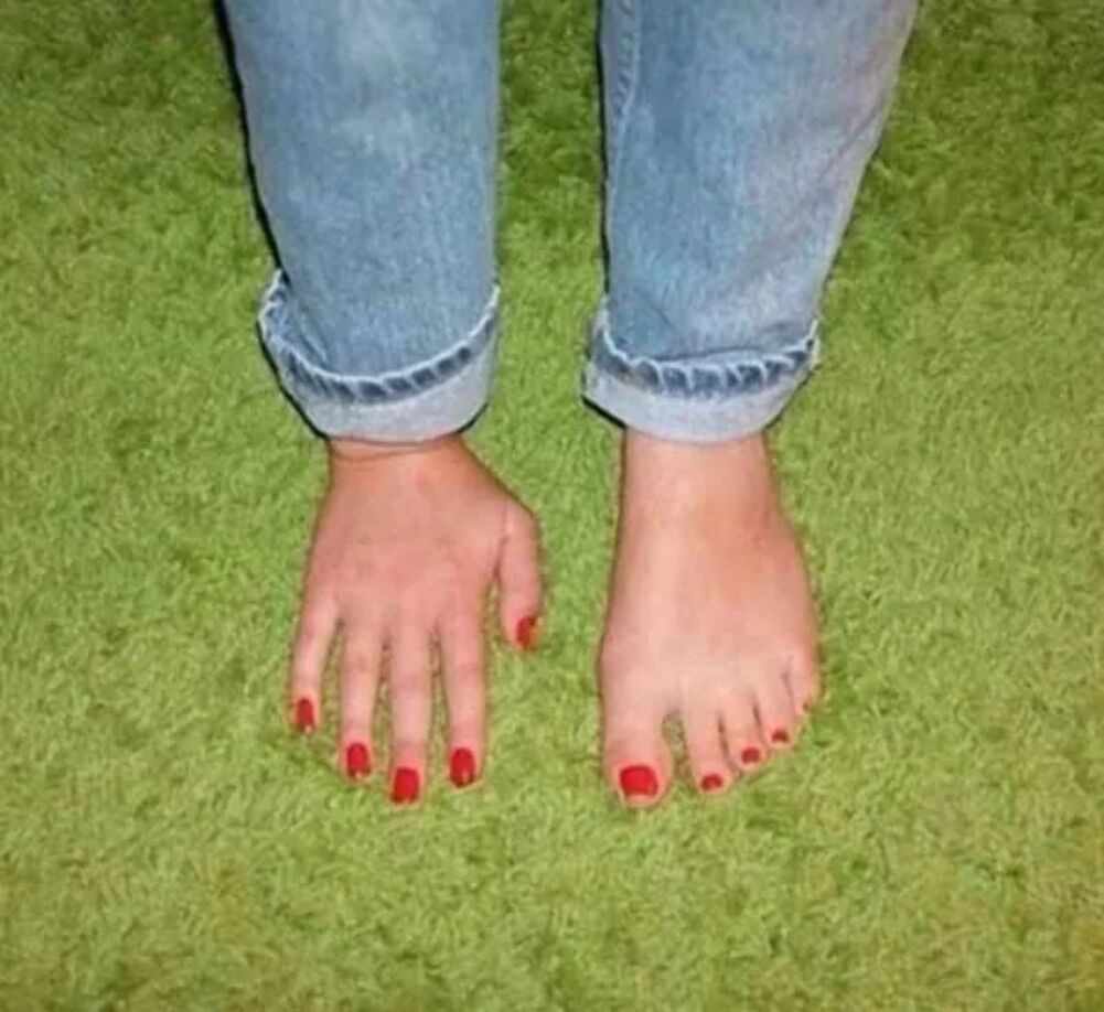 weirdo foot